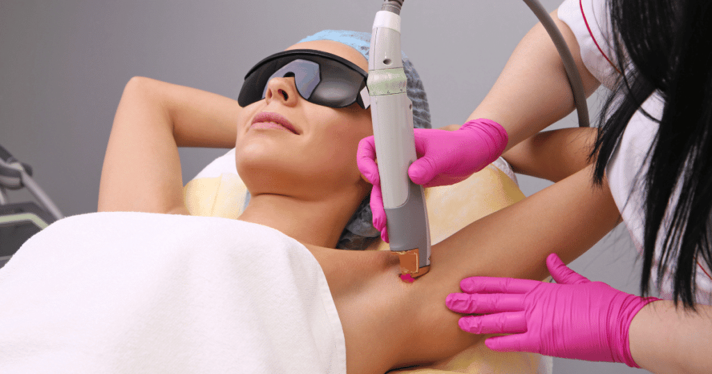 Close-up of a laser hair removal device targeting hair follicles for smooth results.