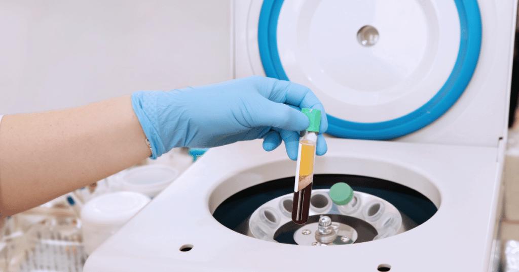 Centrifuge machine preparing platelet-rich plasma (PRP) for therapy.