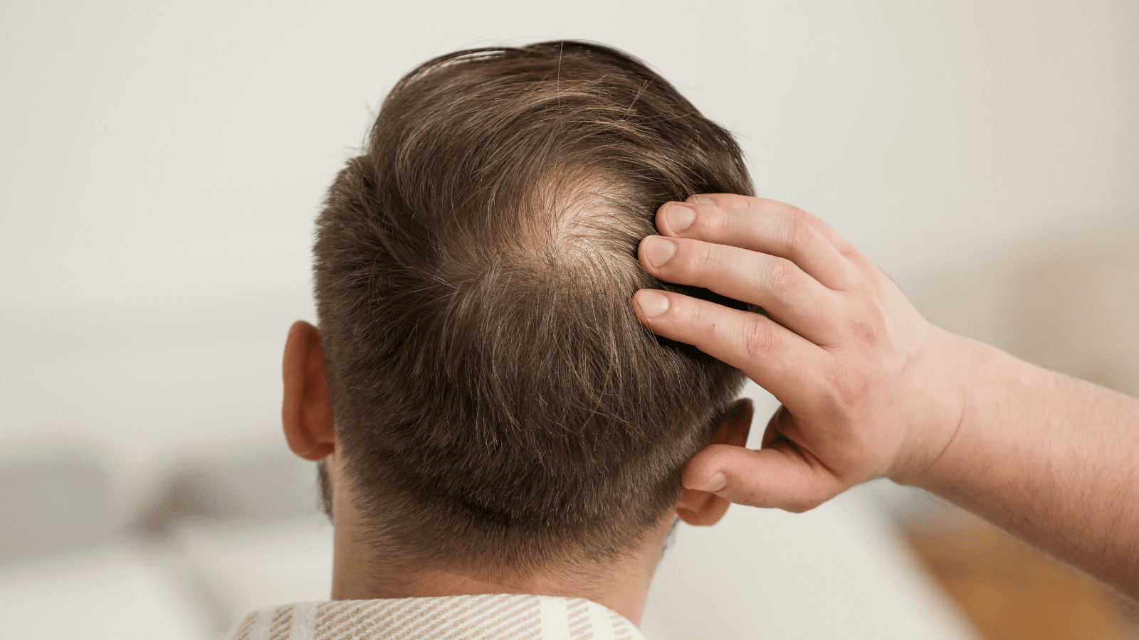 Ideal Candidates for Laser Hair Restoration